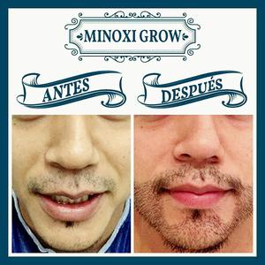 Minoxigrow, Minoxidil 5 crecimiento cabello y barba