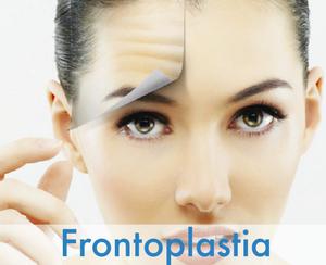 Frontoplastia