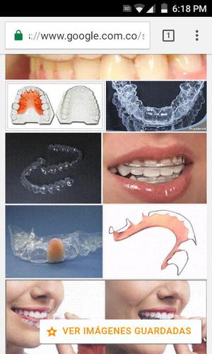 Retenedores Dentales Y Protesis 