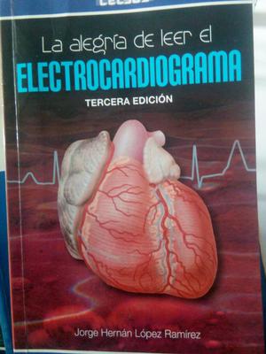 Electrocardiograma