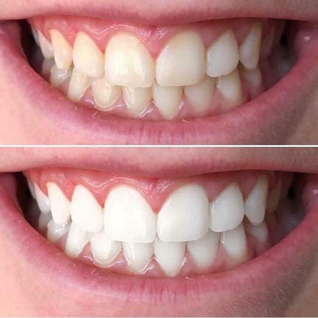 Crema Desmanchadora de Dientes