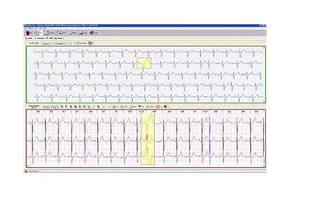 Sistema De Anaisis Holter- Pbi Qrs Card Cs2- Hecho En Usa