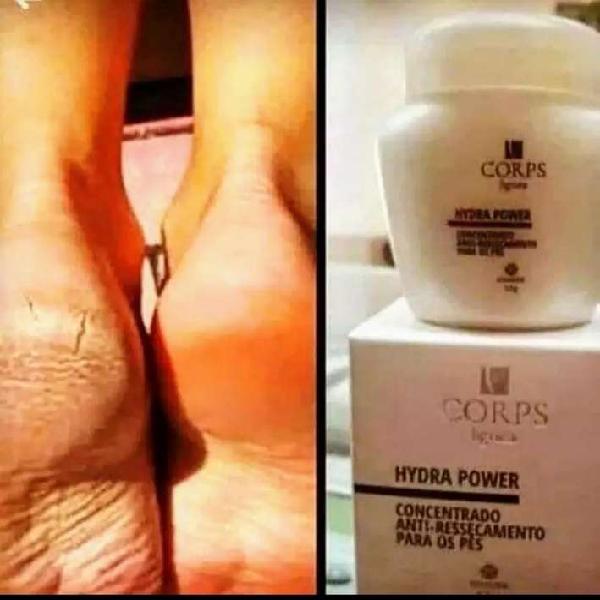 Crema Hydra power para pies