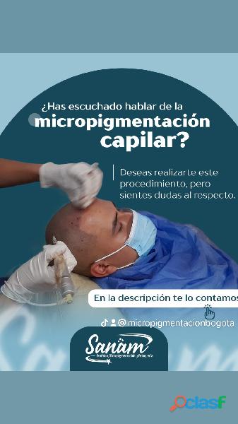 Micropigmentación capilar