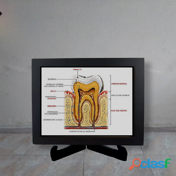 maqueta estructura dental